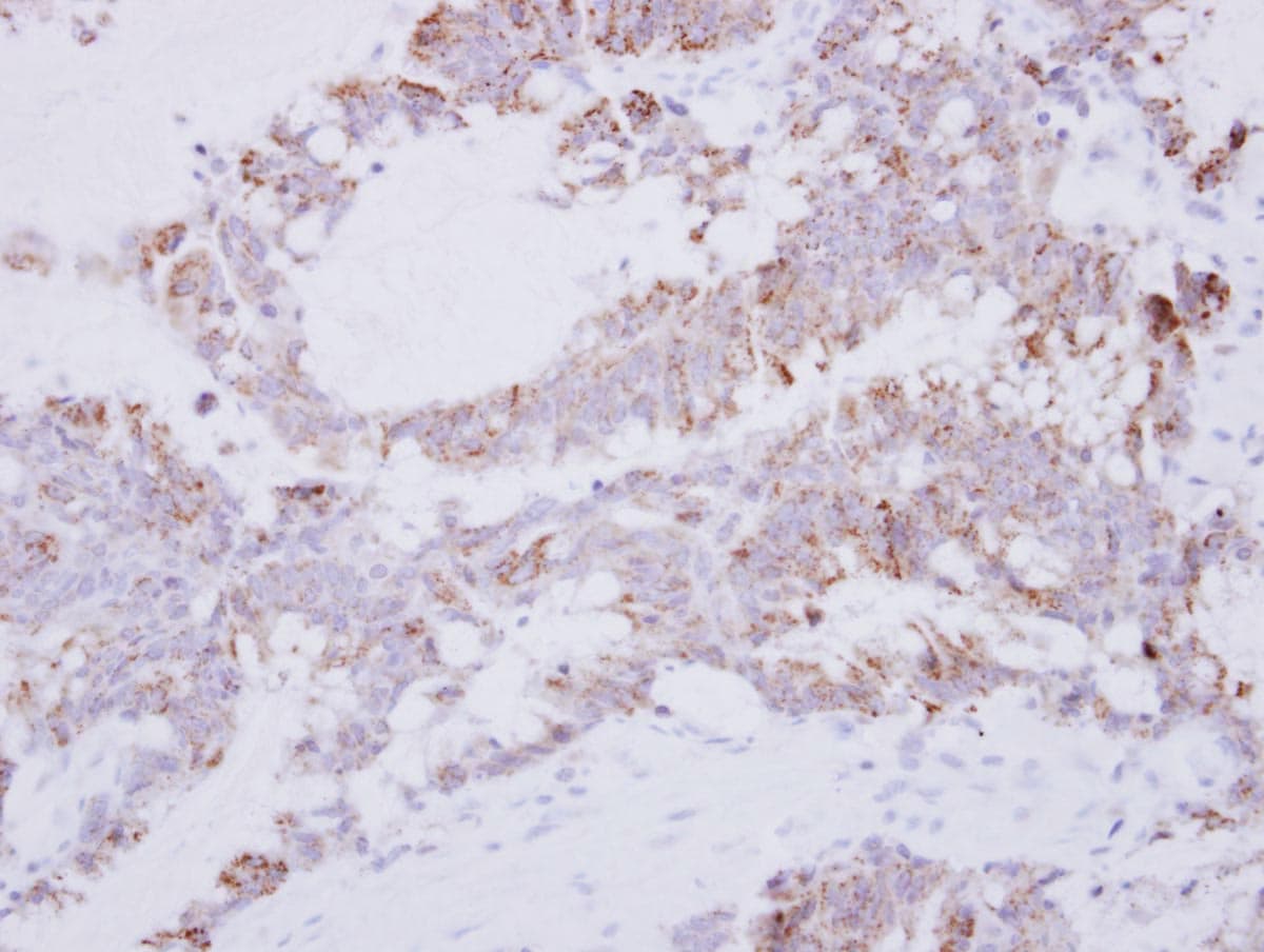 Polyclonal Rabbit anti-Human GRAP2 / GRID Antibody (aa1-174, IHC, WB)