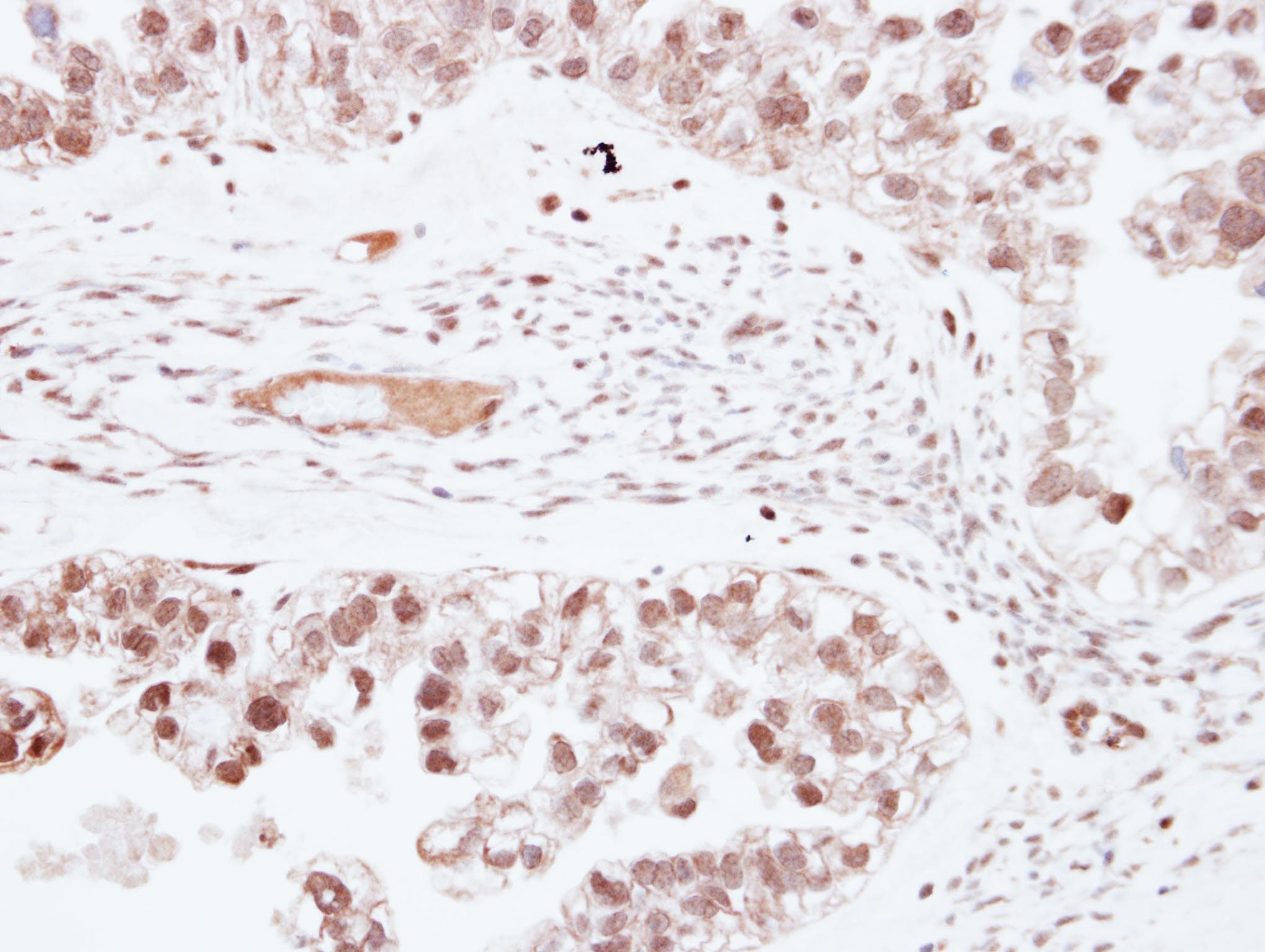 ZNF501 Antibody