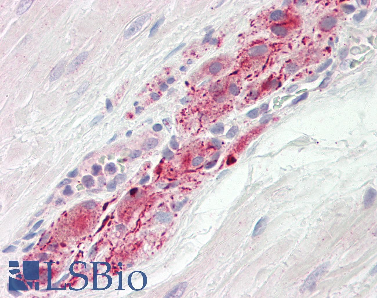 IHC-plus™ RAB3GAP1 Antibody (aa538-587)