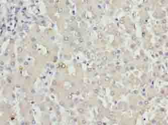KHDC1 / C6orf148 Antibody