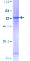 Human STX5 / Syntaxin 5 Protein (Recombinant GST)