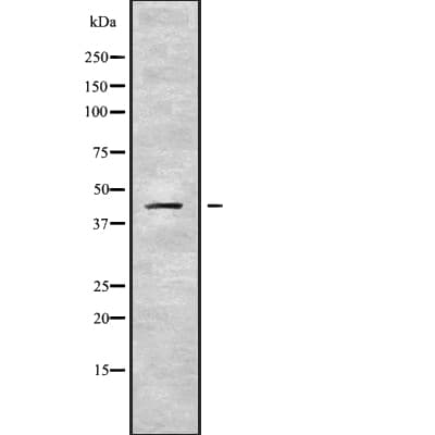 SERPINB10 Antibody