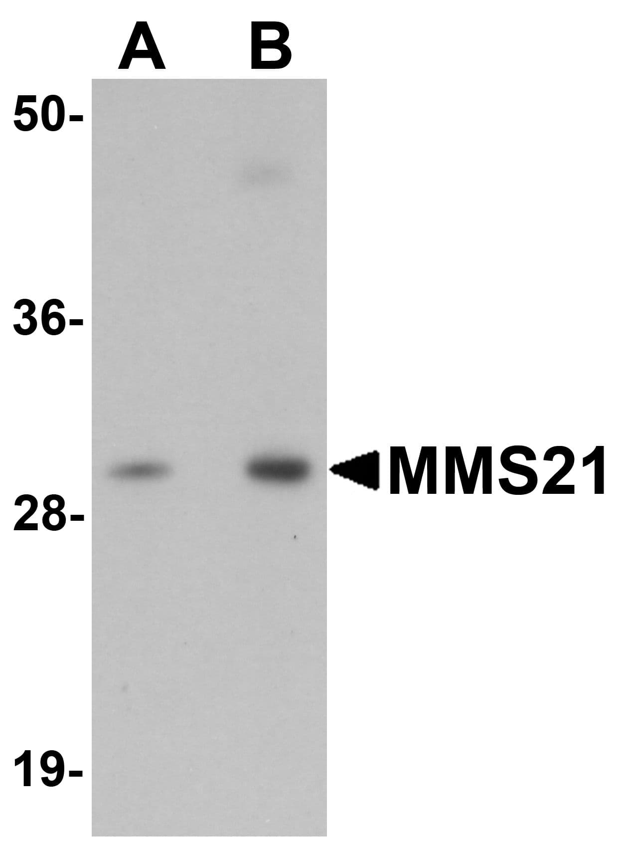 MMS21 / NSMCE2 Antibody
