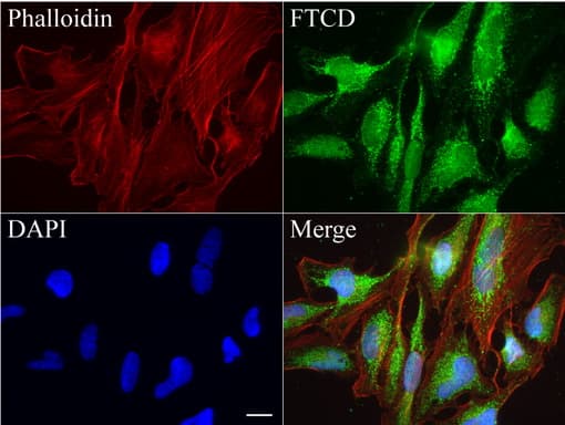 FTCD / 58K Golgi Protein Antibody (clone UMAB123)
