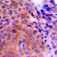 CSNK1G1 / CKI-Gamma 1 Antibody (N-Terminus)