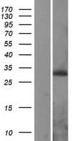 PEX11A Protein (Over-Expression Lysate Myc-DDK (Flag))