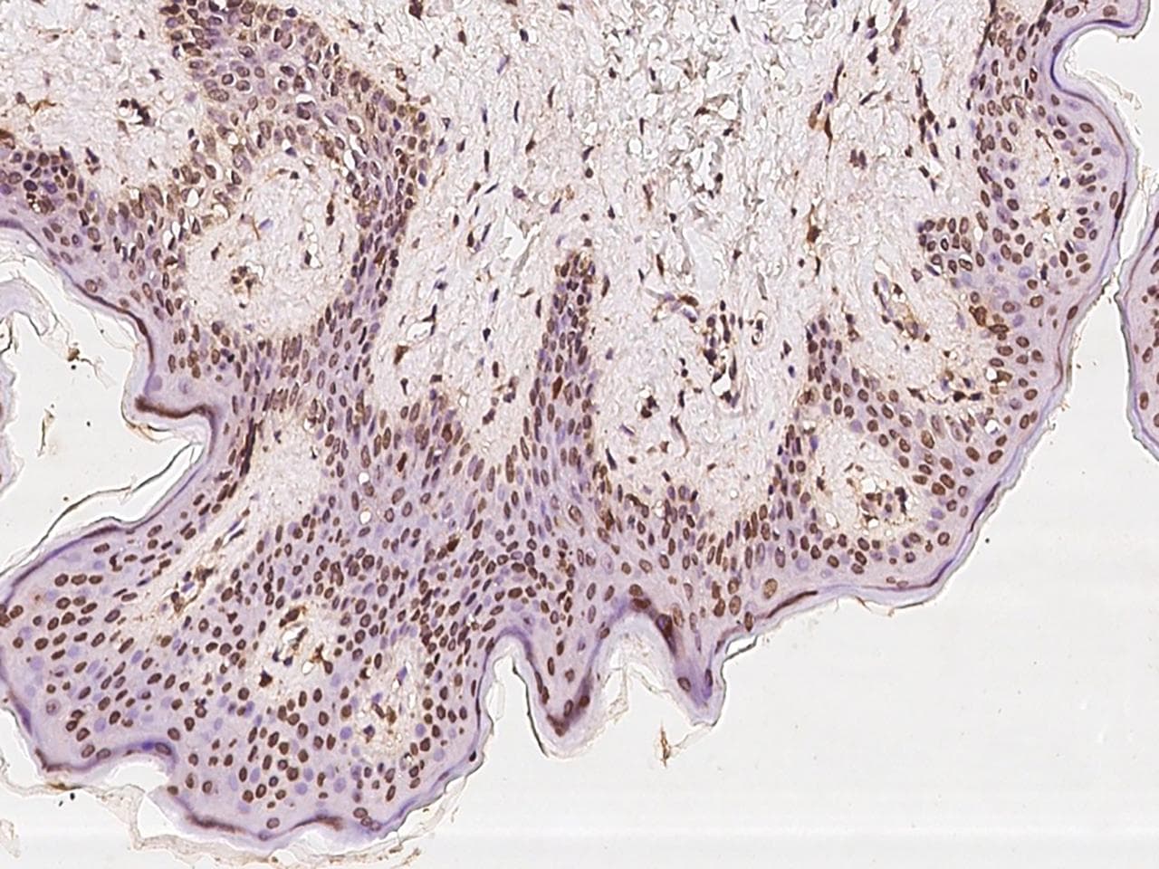 Polyclonal Rabbit anti-Human EXOSC10 Antibody (IHC)