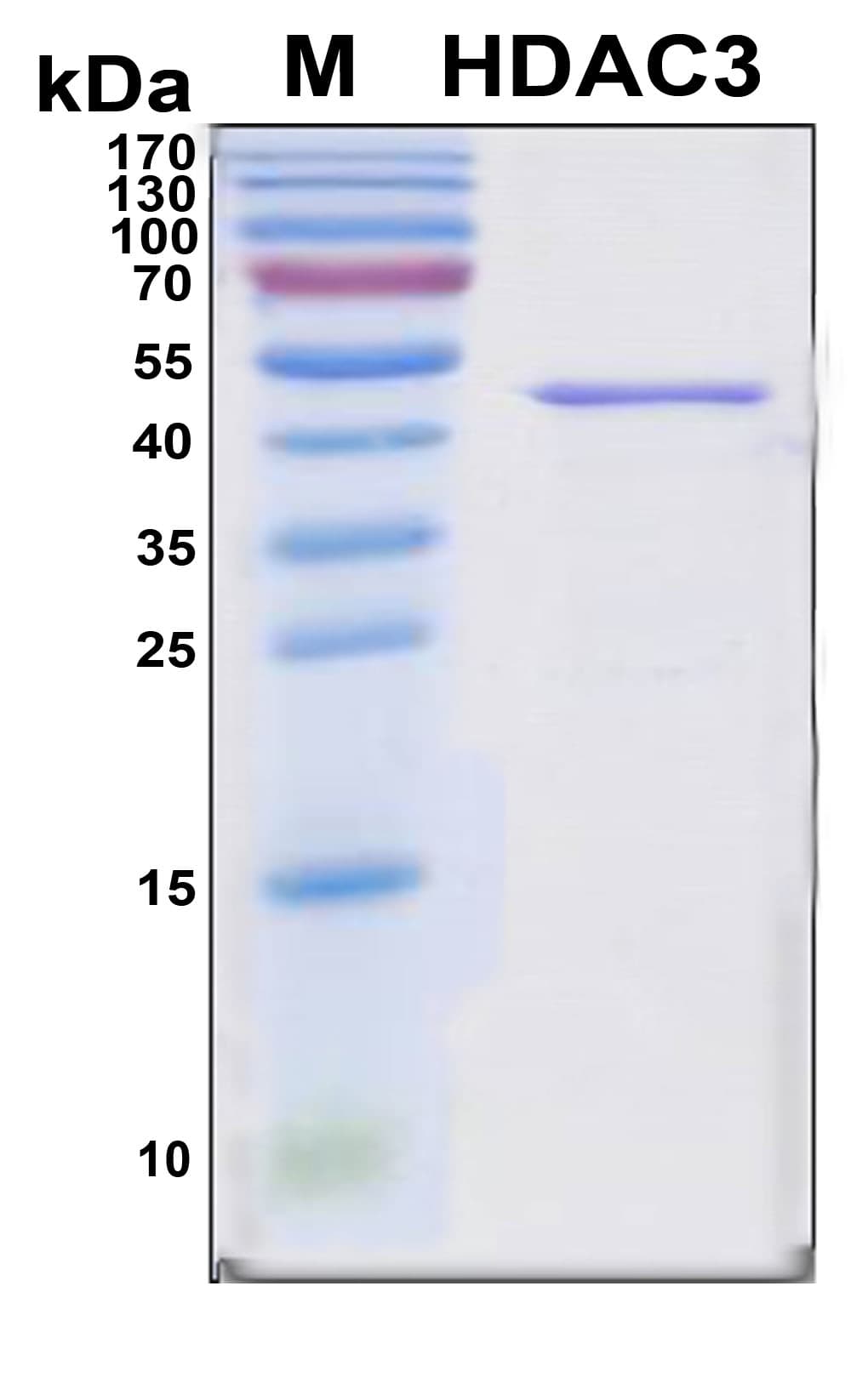 Human HDAC3 Protein (Recombinant 6His, N-terminus)
