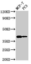 Polyclonal Rabbit anti-Human DNASE2 / DNase II Antibody