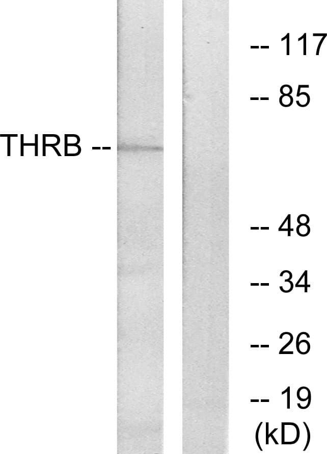 F2 / Prothrombin / Thrombin Antibody (aa391-440)