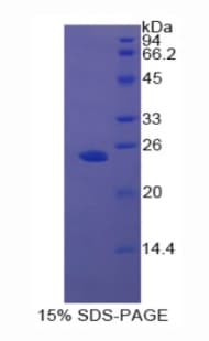 Rat AR / Androgen Receptor Protein (Recombinant His)