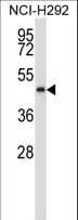 Polyclonal Rabbit anti-Human NADK2 / C5orf33 Antibody (aa122-150, IHC, WB)