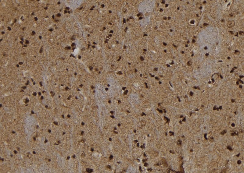 ANXA7 / Annexin VII / SNX Antibody
