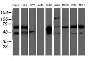 Monoclonal Mouse anti-Human PDE1B Antibody (clone OTI6B9, IF, WB)