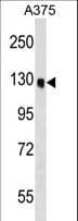 Polyclonal Rabbit anti-Human OSBPL6 Antibody (aa769-796, WB)