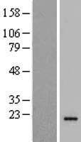 Human TMEM220 Protein (Over-Expression Lysate Myc-DDK (Flag))