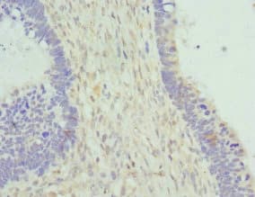 Polyclonal Rabbit anti-Human CYTH2 / Cytohesin 2 Antibody (IHC, WB)