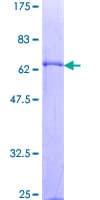 Human AIM / CD5L Protein (Recombinant GST)