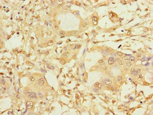 Polyclonal Rabbit anti-Human SPAG9 Antibody (IHC, IF)