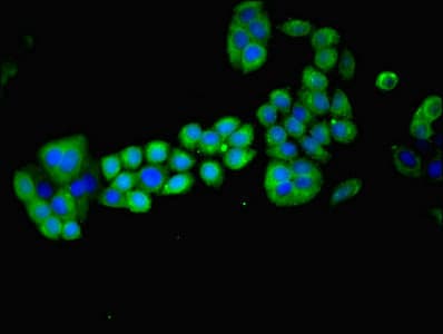 Polyclonal Rabbit anti-Human MAGEA8 Antibody