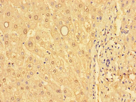 GSTM1 Antibody