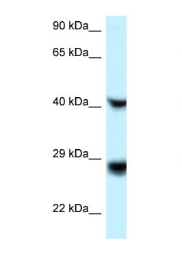 RIT1 Antibody (C-Terminus)