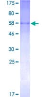 Human ST3GAL2 Protein (Recombinant GST)