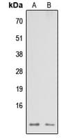 NDUFA3 / B9 Antibody (Internal)