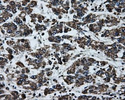 BRAF / B-Raf Antibody (clone OTI1D4)