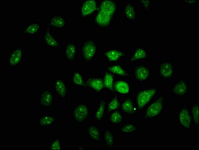 Neurofibromin / NF1 Antibody