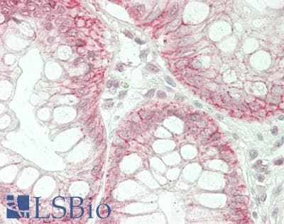IHC-plus™ CLDN7 / Claudin 7 Antibody (aa172-201)