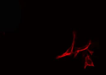 LAMB2 / Laminin Beta 2 Antibody