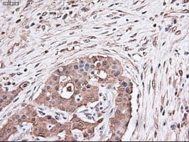 TRIM33 / TIF1-Gamma Antibody (clone OTI9D4)