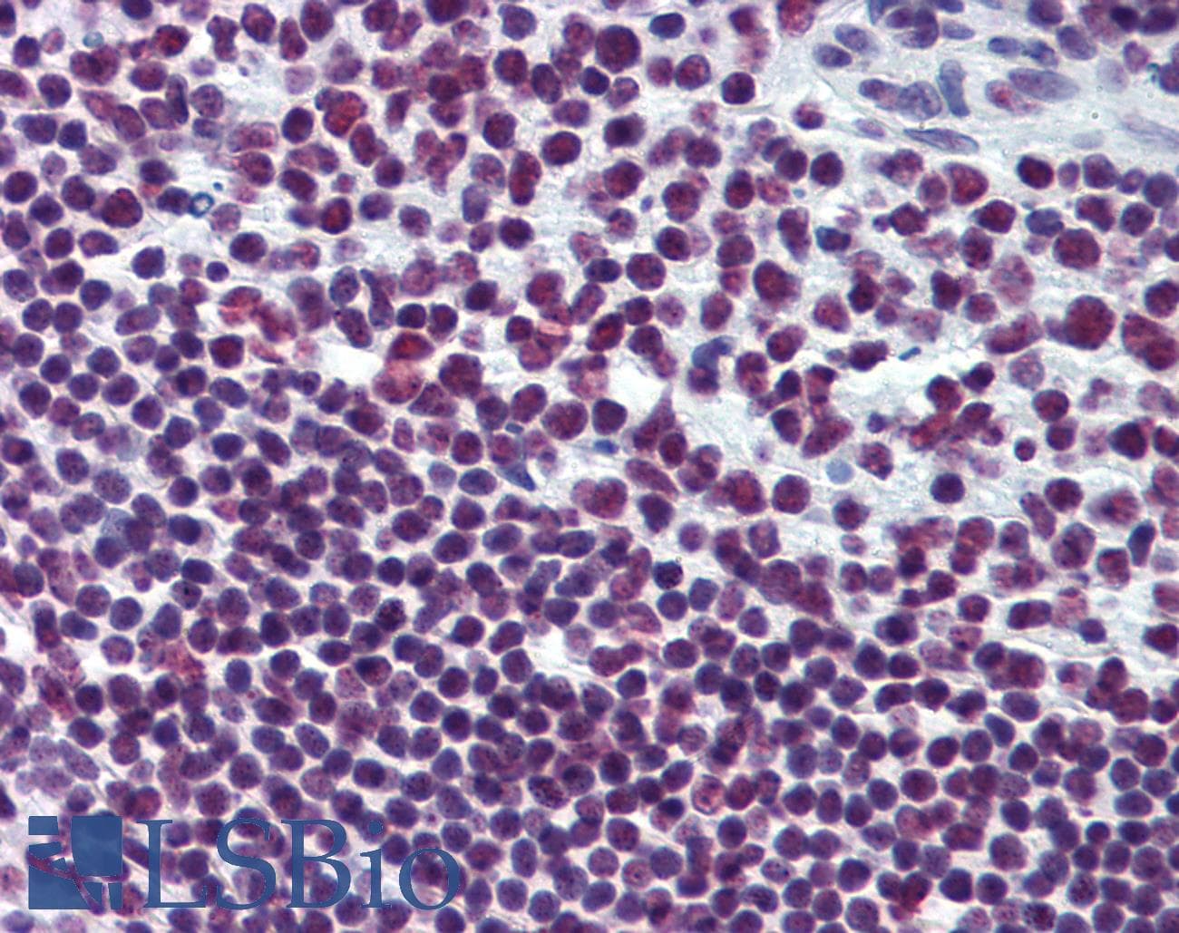 IHC-plus™ Monoclonal Mouse anti-Human EWSR1 / EWS Antibody (clone 5C10, IHC, WB)