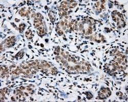 p66 / SHC Antibody (clone OTI3A1)