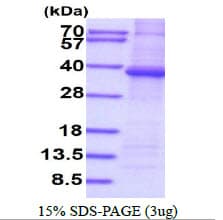 Human PPP1R3B Protein (Recombinant His)