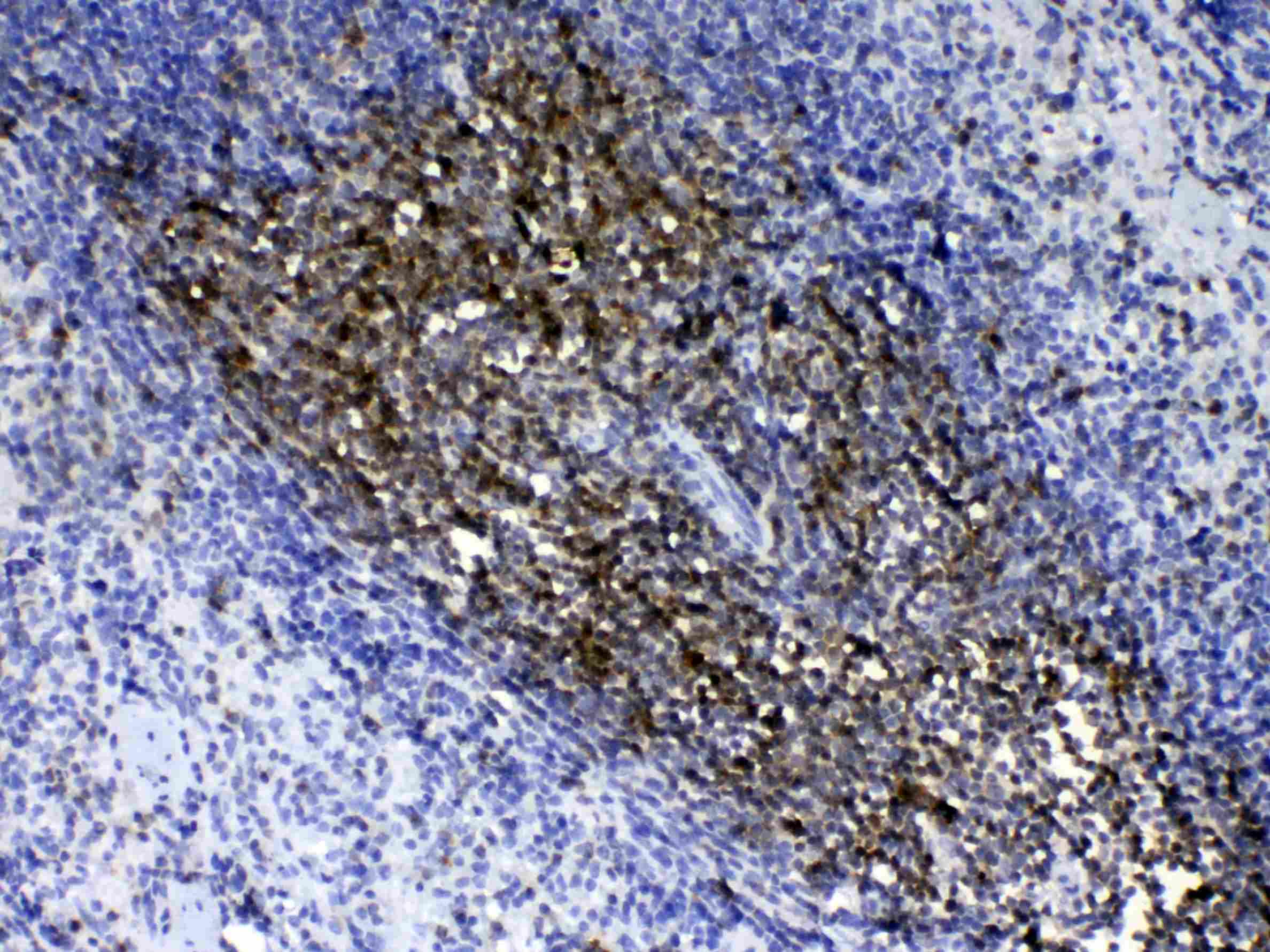 THY1 / CD90 Antibody
