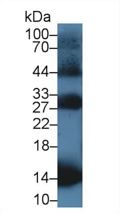 HBB / Hemoglobin Beta Antibody (aa1-147, APC)