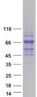 Human TBC1D10A Protein (Recombinant Myc-DDK (Flag))