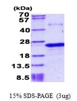 Human PNOC / Nociceptin Protein (Recombinant His)