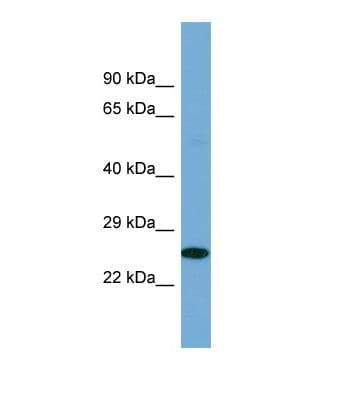 POU2F3 / PLA-1 Antibody (aa366-415)