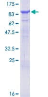 Human SPHK2 Protein (Recombinant GST)