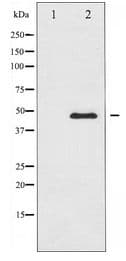 Polyclonal Rabbit anti-Human PTP1B Antibody (IHC, WB)