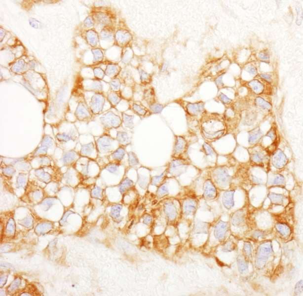 Polyclonal Rabbit anti-Human RCN1 / Reticulocalbin 1 Antibody (aa1-75, IHC, WB)