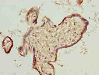 TMEM65 Antibody