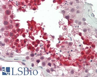 IHC-plus™ Polyclonal Rabbit anti-Human CXXC1 / CGBP Antibody (IHC, IF, WB)