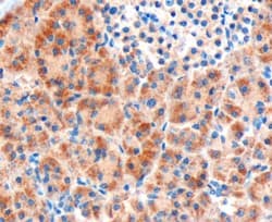 FZD8 / Frizzled 8 Antibody (aa684-694)