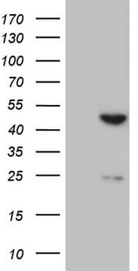 XRCC3 Antibody (aa1-235, clone OTI4F3)