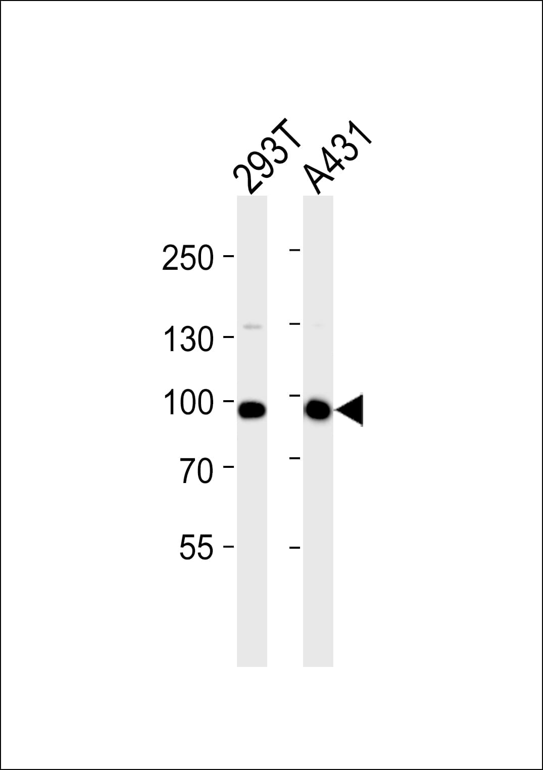 IL4R / CD124 Antibody (aa677-691)