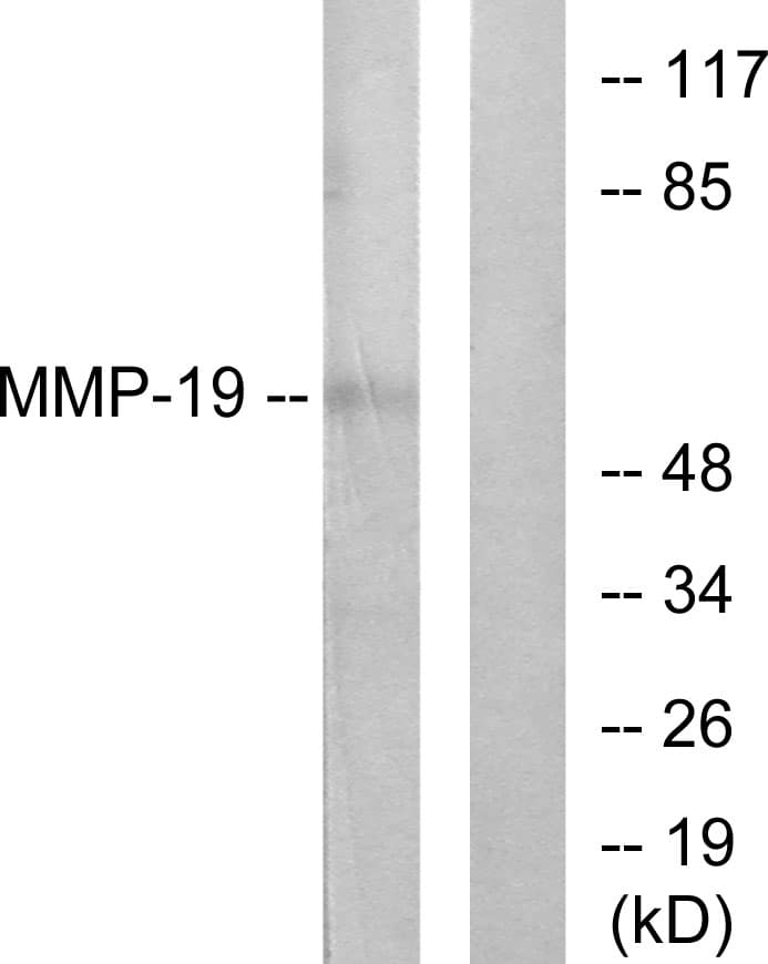 MMP19 Antibody (aa11-60)